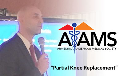 AAMS – Partial Knee Replacement